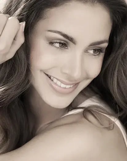 vanguard-plastic-surgery-restylane-procedure-ft-lauderdale-413x522