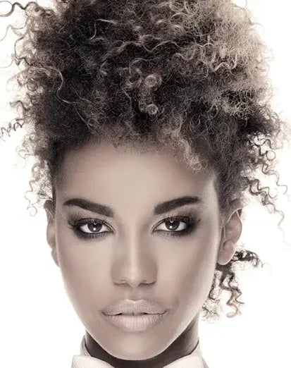 vanguard-plastic-surgery-voluma-procedure-ft-lauderdale-413x522